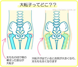 大転子とは、左右の腰骨の出っ張りの部分」